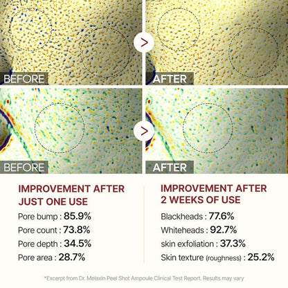 Dr. Melaxin Rice Peel Glow Shot (Set of 2)